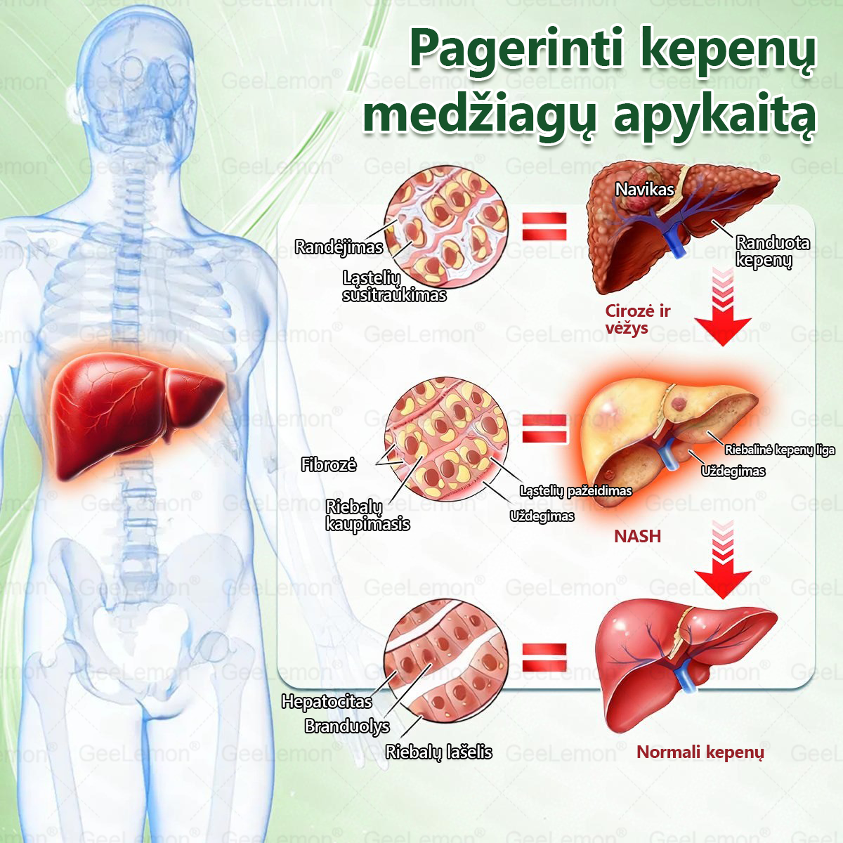 Rekomenduojama Santaros klinikų · 👩‍⚕️ Oficiali „Eurovaistinė“ vaistinė🎁 𝐆𝐞𝑒𝐿𝑒𝐦𝐨𝐧® 𝐆𝐥𝐮𝐦𝐚𝐬𝐞𝐭𝐢𝐝𝐞 8 viename Liekninantis ir sveikatinantis nano pleistras su mikroadatomis 🇱🇹 (Tik kartą per dieną, matomi pokyčiai jau per 7 dienas)  ✅