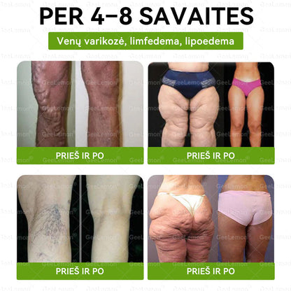 Rekomenduojama Santaros klinikų · 👩‍⚕️ Oficiali „Eurovaistinė“ vaistinė🎁 𝐆𝐞𝑒𝐿𝑒𝐦𝐨𝐧® 𝐆𝐥𝐮𝐦𝐚𝐬𝐞𝐭𝐢𝐝𝐞 8 viename Liekninantis ir sveikatinantis nano pleistras su mikroadatomis 🇱🇹 (Tik kartą per dieną, matomi pokyčiai jau per 7 dienas)  ✅
