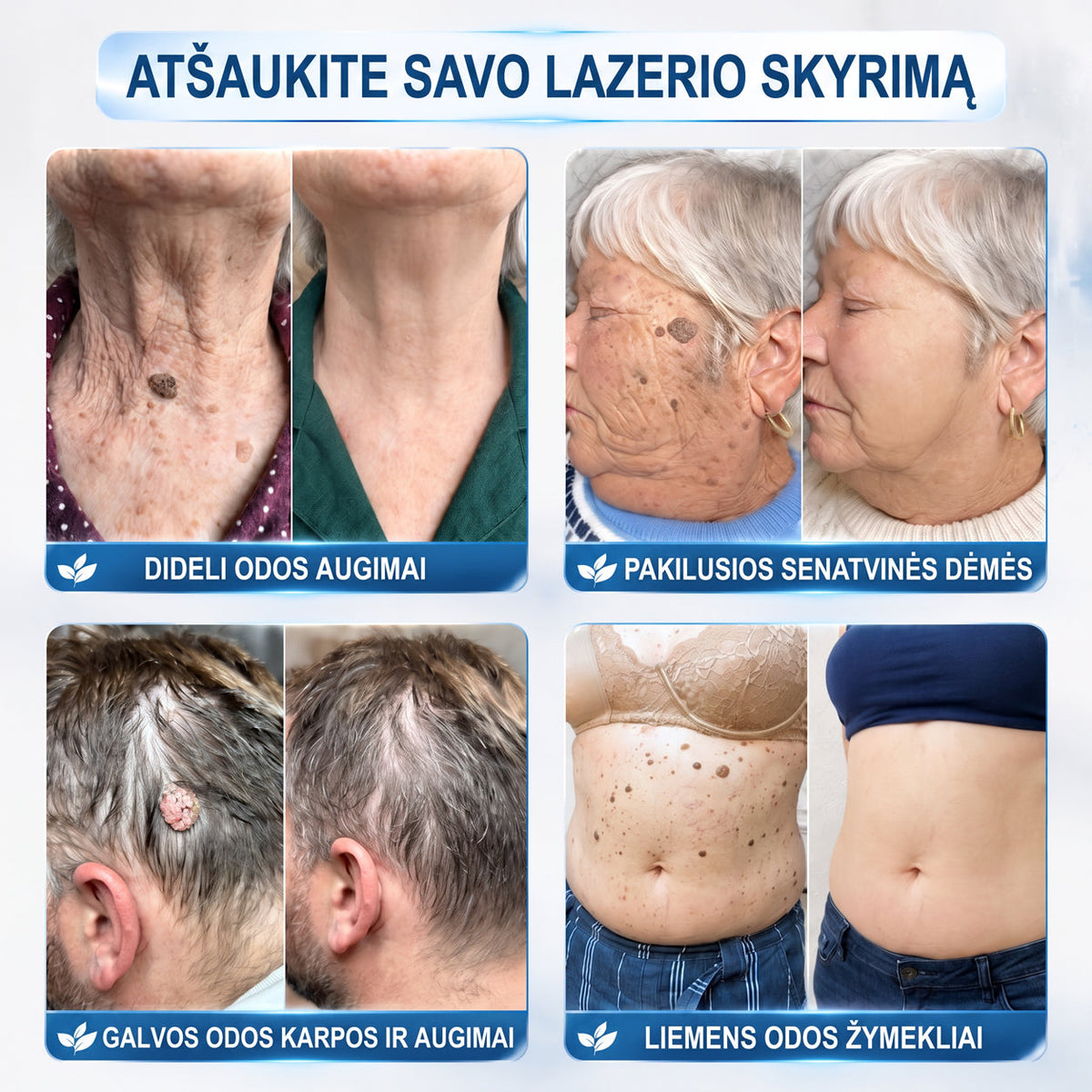 ✅✨𝐎𝐟𝐢𝐜𝐢𝐚𝐥𝐢 𝐩𝐫𝐞𝐤ė𝐬 ž𝐞𝐧𝐤𝐥𝐨 𝐩𝐚𝐫𝐝𝐮𝐨𝐭𝐮𝐯ė Hiskin® 𝟕 𝐝𝐚𝐲 𝐊𝐚𝐫𝐩𝐮𝐜𝐢𝐮 𝐢𝐫 𝐝𝐞𝐦𝐢𝐲 𝐯𝐚𝐥𝐢𝐤𝐥𝐢𝐬(Neskausmingas, be pėdsakų rutulinis rutulinis) 🚀