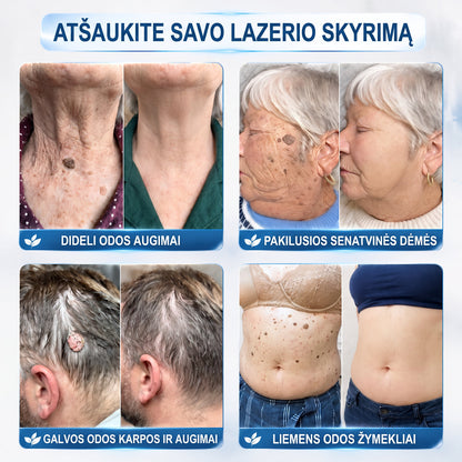 ✅✨𝐎𝐟𝐢𝐜𝐢𝐚𝐥𝐢 𝐩𝐫𝐞𝐤ė𝐬 ž𝐞𝐧𝐤𝐥𝐨 𝐩𝐚𝐫𝐝𝐮𝐨𝐭𝐮𝐯ė Hiskin® 𝟕 𝐝𝐚𝐲 𝐊𝐚𝐫𝐩𝐮𝐜𝐢𝐮 𝐢𝐫 𝐝𝐞𝐦𝐢𝐲 𝐯𝐚𝐥𝐢𝐤𝐥𝐢𝐬(Neskausmingas, be pėdsakų rutulinis rutulinis) 🚀