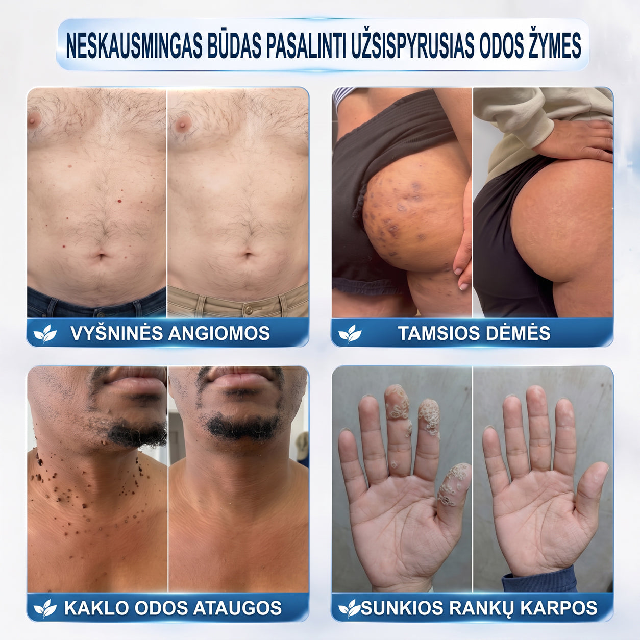 ✅✨𝐎𝐟𝐢𝐜𝐢𝐚𝐥𝐢 𝐩𝐫𝐞𝐤ė𝐬 ž𝐞𝐧𝐤𝐥𝐨 𝐩𝐚𝐫𝐝𝐮𝐨𝐭𝐮𝐯ė Hiskin® 𝟕 𝐝𝐚𝐲 𝐊𝐚𝐫𝐩𝐮𝐜𝐢𝐮 𝐢𝐫 𝐝𝐞𝐦𝐢𝐲 𝐯𝐚𝐥𝐢𝐤𝐥𝐢𝐬(Neskausmingas, be pėdsakų rutulinis rutulinis) 🚀