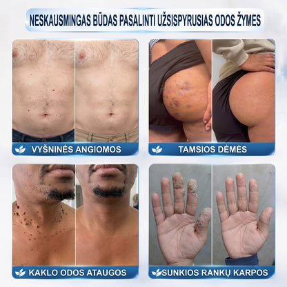 ✅✨𝐎𝐟𝐢𝐜𝐢𝐚𝐥𝐢 𝐩𝐫𝐞𝐤ė𝐬 ž𝐞𝐧𝐤𝐥𝐨 𝐩𝐚𝐫𝐝𝐮𝐨𝐭𝐮𝐯ė Hiskin® 𝟕 𝐝𝐚𝐲 𝐊𝐚𝐫𝐩𝐮𝐜𝐢𝐮 𝐢𝐫 𝐝𝐞𝐦𝐢𝐲 𝐯𝐚𝐥𝐢𝐤𝐥𝐢𝐬(Neskausmingas, be pėdsakų rutulinis rutulinis) 🚀