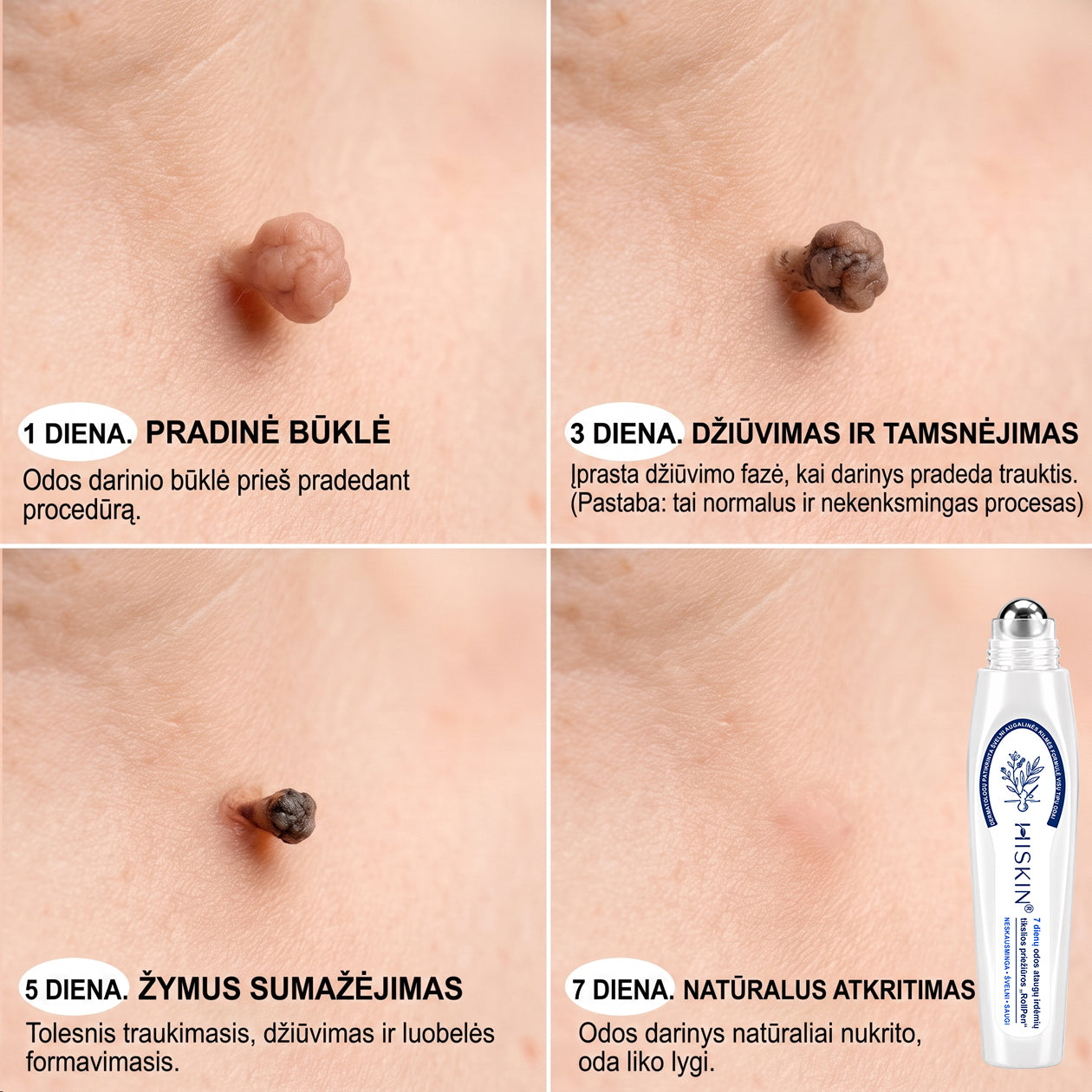 ✅✨𝐎𝐟𝐢𝐜𝐢𝐚𝐥𝐢 𝐩𝐫𝐞𝐤ė𝐬 ž𝐞𝐧𝐤𝐥𝐨 𝐩𝐚𝐫𝐝𝐮𝐨𝐭𝐮𝐯ė Hiskin® 𝟕 𝐝𝐚𝐲 𝐊𝐚𝐫𝐩𝐮𝐜𝐢𝐮 𝐢𝐫 𝐝𝐞𝐦𝐢𝐲 𝐯𝐚𝐥𝐢𝐤𝐥𝐢𝐬(Neskausmingas, be pėdsakų rutulinis rutulinis) 🚀